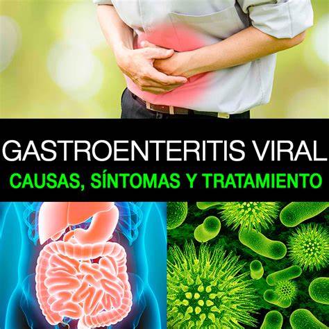 Gastroenteritis Viral Tratamiento